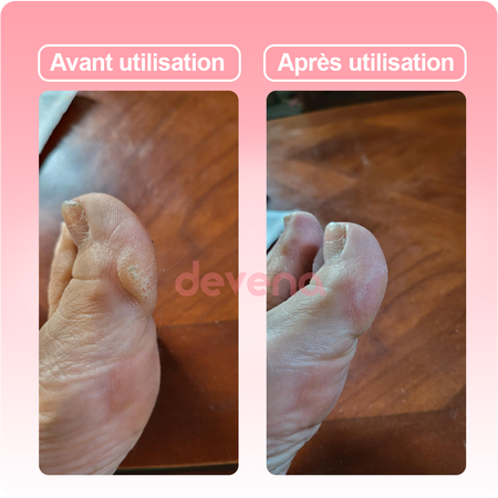 Ponceuse Glow - Retrouvez l'éclat et la douceur de votre peau comme au premier jour